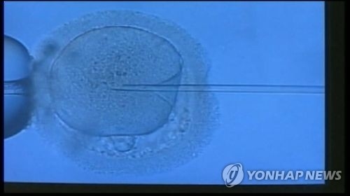 부산서 불임치료 실수 덮으려 낙태주사 투여 의혹 수사