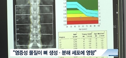 [쿠키건강뉴스] “복부비만 20대 남성, 골다공증 위험 5.5배”