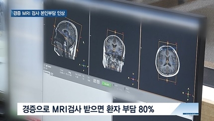 [쿠키건강뉴스] 3월부터 두통 등 경증 MRI검사 본인부담 인상