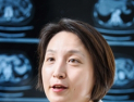[진료실에서] ‘명절에 음복 한두 잔’, 만성간질환 환자 주의