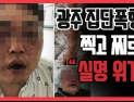 [쿠키영상] 광주 집단폭행, 돌로 찍고 나뭇가지로 찌르고 “실명 위기에 처했다”…‘강력한 처벌’ 국민청원 후끈