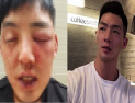 [쿠키영상] 차오름, 머슬마니아 양호석 폭행 고소 “남자답게 맞은 것뿐”…양호석 “시간 지나면 알게 된다”