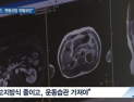 [쿠키건강뉴스] “복부비만 50세 이상 남성, 전립선암 위험 높아”
