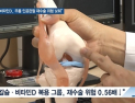 [쿠키건강뉴스] “칼슘·비타민D, 무릎 인공관절 재수술 위험 낮춰”