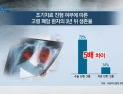 [쿠키건강뉴스] “고령 폐암 환자도 조기치료 받으면 생존율 5배”