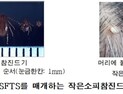 경북·충남서 올해 첫 SFTS 사망자 발생…'참진드기 물림' 주의