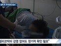 [쿠키건강뉴스] “위 선종, 내시경 절제 후 추적관찰 필요”