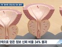 [쿠키건강뉴스] ‘전립선암 의심’ 10명 중 7명 “검색 정보 올바른지 몰라”