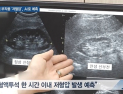 [쿠키건강뉴스] 혈액투석 부작용 ‘저혈압’…인공지능으로 예측