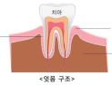 잇몸 통증 계속된다면? 복용약도 체크해야