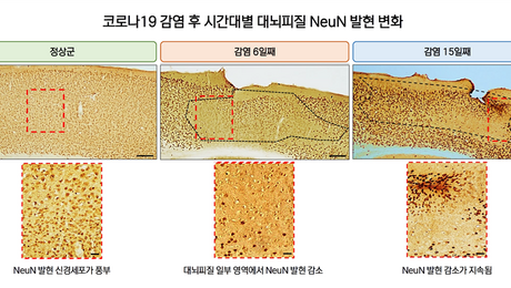 [쿠키과학] 코로나19 후유증 ‘브레인 포그’ 원인 찾았다… KIT-화학연, 뇌 오렉신 시스템 이상 규명